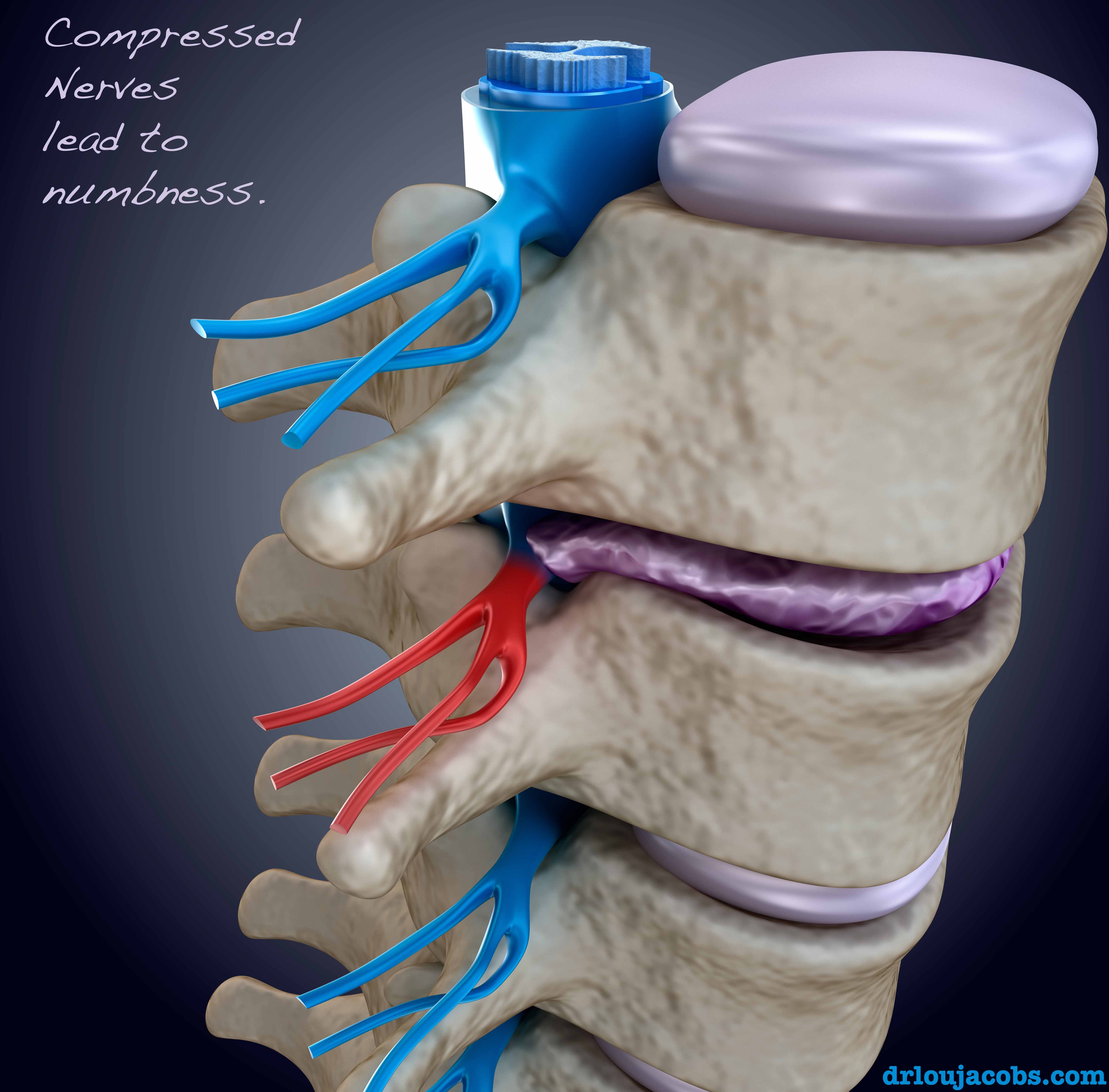 Numbness Somewhere In Your Body? Want Answers? Get Checked.