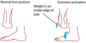 Pronation causes pain