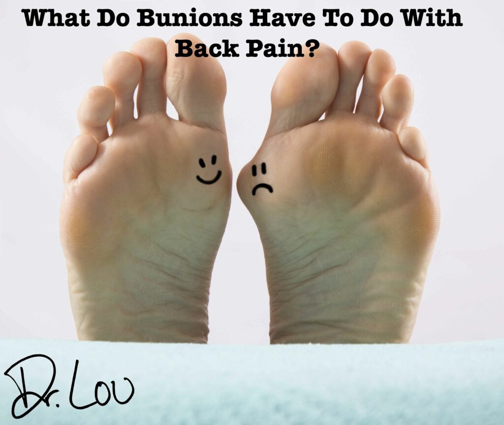 Are Your Bunions Related To Back Pain And Spinal Degeneration? Jacobs