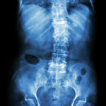 What is the spine?