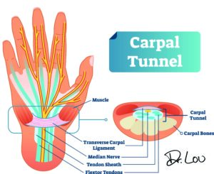 Are you a guitarist and suspect you have carpal tunnel syndrome? Try these exercises from Dr. Lou! Questions? Call Dr. Lou at (207) SPINAL 1