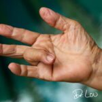 Trigger finger pain and immobility could end a musician's career. Call Dr. Lou at (207) 774-6251